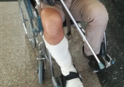 Brak odkodowania za uraz.