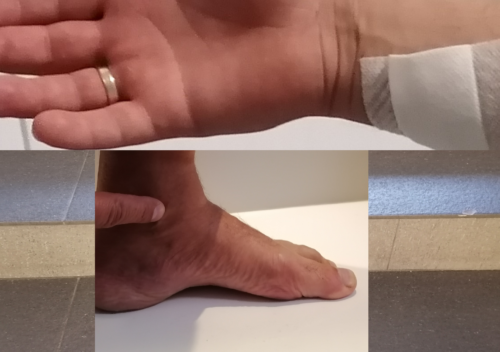 przyczyna zewnętrzna wypadku przy pracy